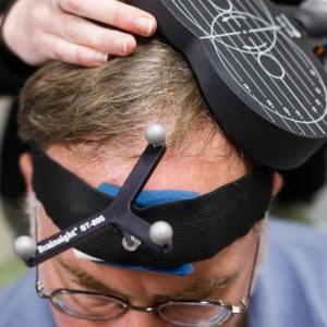 Man's head with magnetic stimulation device and technician's hands